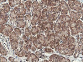 OTUB1 / OTU1 Antibody (clone OTI5B8)