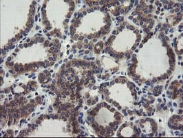 COMMD1 Antibody (clone OTI3B3)