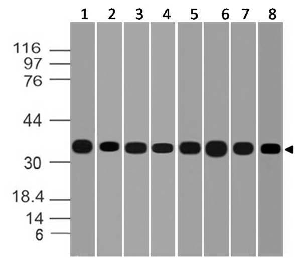 IHC-plus™ Monoclonal Mouse anti-Human GAPDH Antibody (clone ABM22C5, aa120-320, IHC, WB)