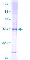 Human TIM23 Protein (Recombinant GST)