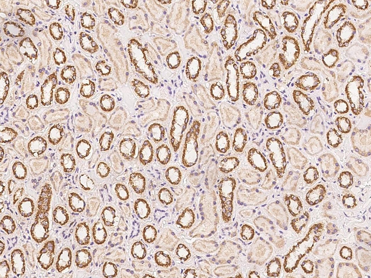 SLX1A / GIYD1 Antibody