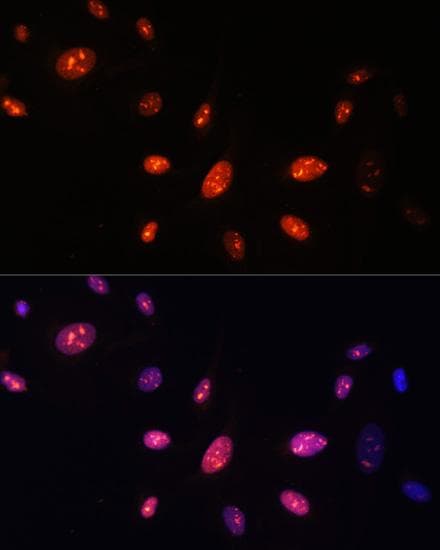 ZNF177 / PIGX Antibody