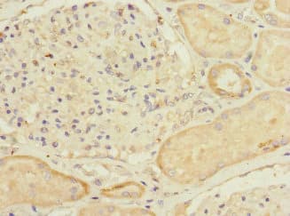 MYLK4 Antibody