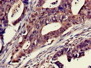 Polyclonal Rabbit anti-Human MPS1 / TTK Antibody (IHC, IF)