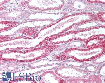 IHC-plus™ Polyclonal Rabbit anti-Human GNT-V / MGAT5 Antibody (IHC, WB)
