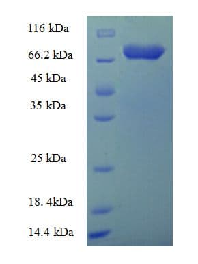 Human ATG16L1 / ATG16L Protein (Recombinant His-SUMO)