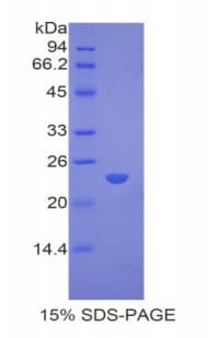 Rabbit PPARG / PPAR Gamma Protein (Recombinant His)
