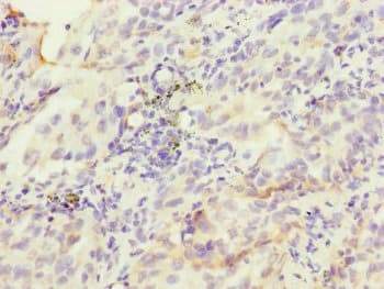 Polyclonal Rabbit anti-Human HK3 / Hexokinase 3 Antibody (IHC)