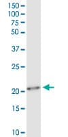 Monoclonal Mouse anti-Human TWIST1 / TWIST Antibody (clone 3E11, WB)