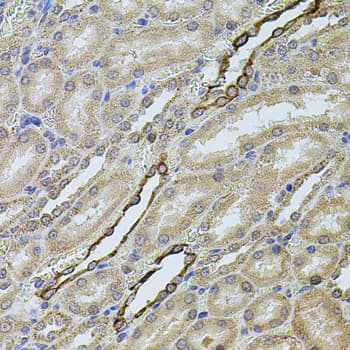 Polyclonal Rabbit anti-Human CHRFAM7A Antibody (IHC, WB)
