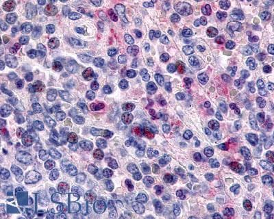 PathPlus™ CCR1 Antibody (Extracellular Domain)