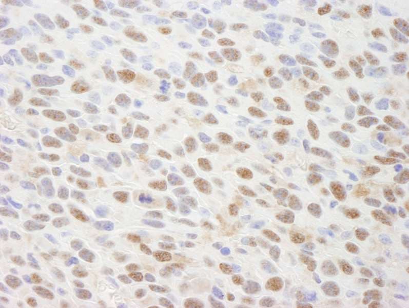 PSMC5 / SUG1 Antibody (aa1-50)