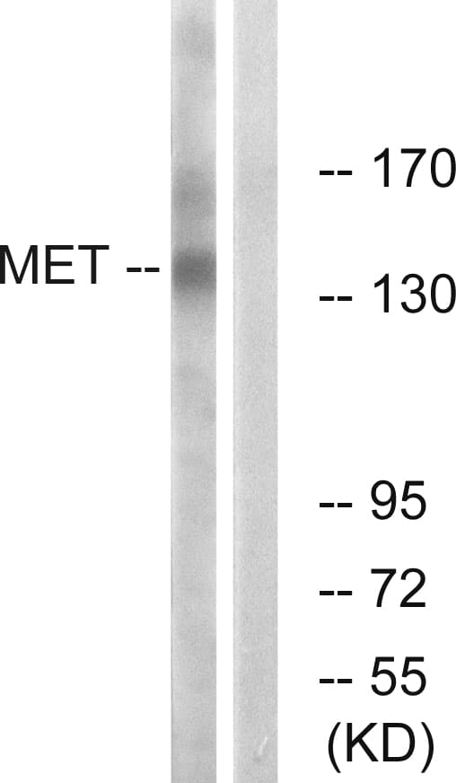 IHC-plus™ c-Met Antibody (aa1316-1365)