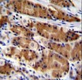Polyclonal Rabbit anti-Human CCDC84 Antibody (aa34-62, IHC, WB)