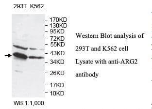 IHC-plus™ Polyclonal Rabbit anti-Human ARG2 / Arginase 2 Antibody (aa180-348, IHC, WB)