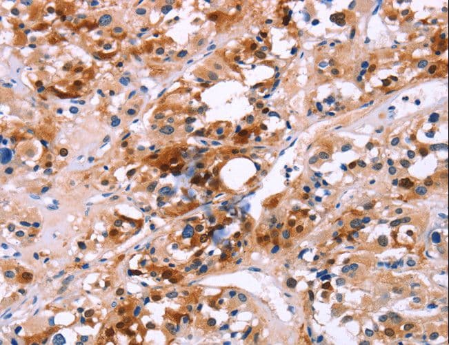 Polyclonal Rabbit anti-Human CALB1 / Calbindin Antibody (IHC, WB)