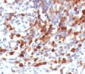 CD79A / CD79 Alpha Antibody (clone CDLA79a-1)