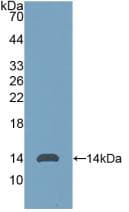 AMH / Anti-Mullerian Hormone Antibody (aa453-560)