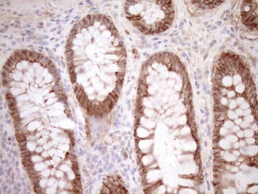CAPN5 / Calpain 5 Antibody (aa274-578, clone OTI7D2, Carrier-free)