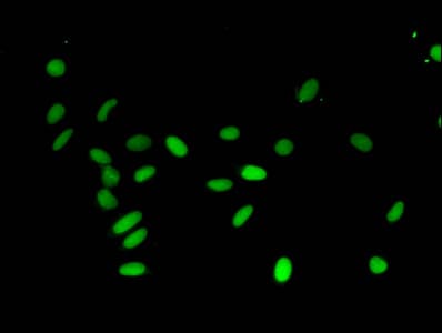 Polyclonal Rabbit anti-Human HIST1H3A Antibody (IHC, IF, WB)