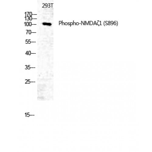 Polyclonal Rabbit anti-Human GRIN1 / NMDAR1 Antibody (840-920 aa, IHC, WB)