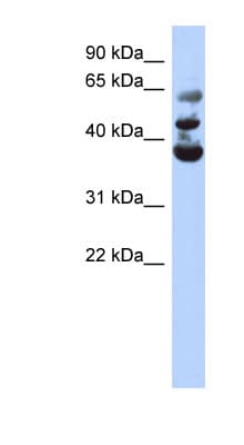 NSUN3 Antibody (aa143-192)