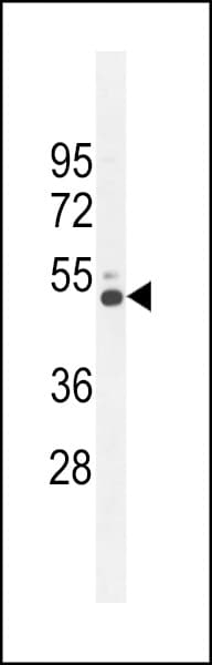 IHC-plus™ Polyclonal Rabbit anti-Human CRHR2 / CRF2 Receptor Antibody (aa10-39, IHC, WB)