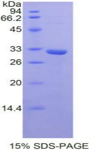 Mouse STAMBP / AMSH Protein (Recombinant His-T7)