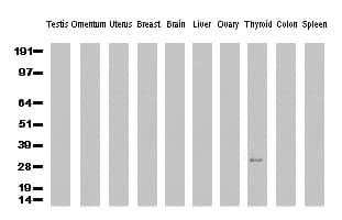 CD20 Antibody (clone UMAB38)