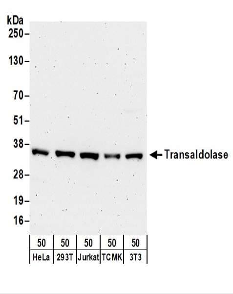 IHC-plus™ TALDO1 / Transaldolase 1 Antibody (aa267-317)