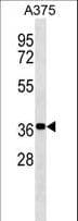 NSMCE1 Antibody (aa222-249)