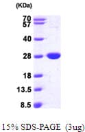 E. coli nfsB Protein (Recombinant His)