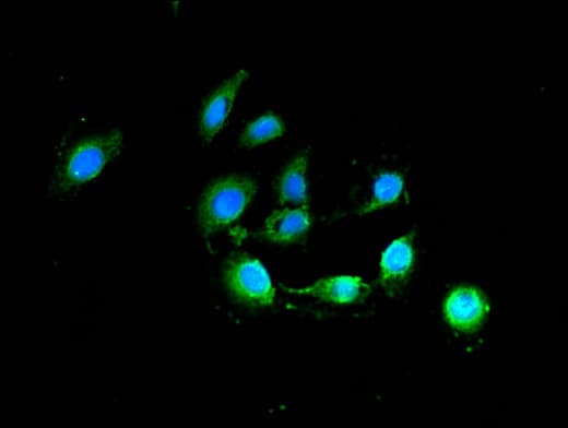 BCL2 / Bcl-2 Antibody
