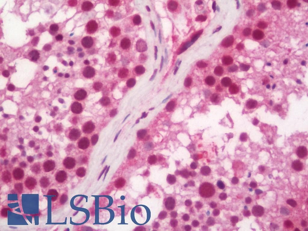IHC-plus™ AKT3 Antibody (aa88-118)
