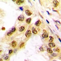Polyclonal Rabbit anti-Human JUN / c-Jun Antibody (Internal, IHC, WB)