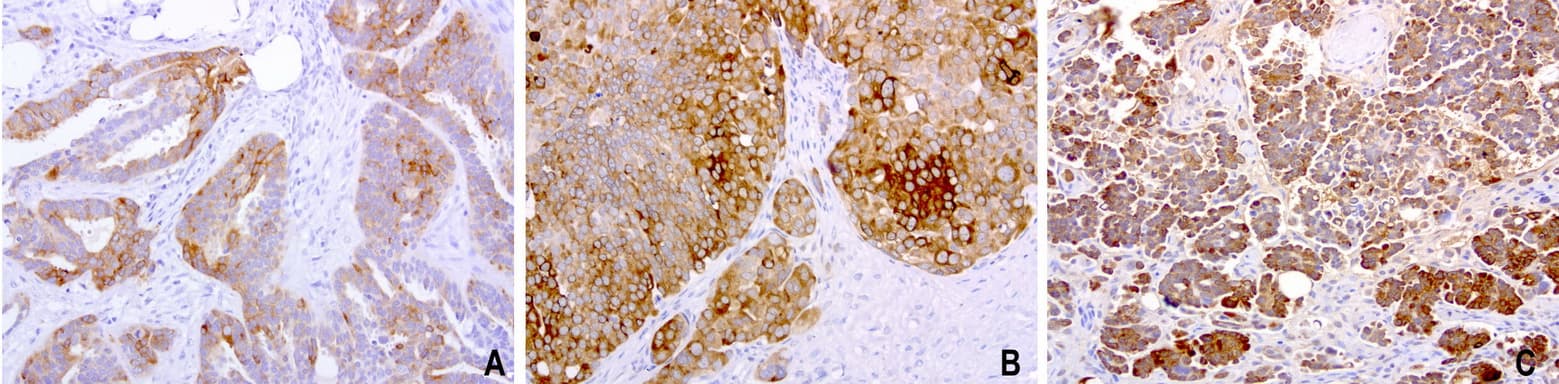 WFDC2 / HE4 Antibody (aa31-124, clone UMAB87)