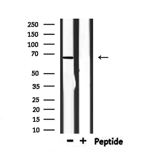BTRCP / BETA-TRCP Antibody