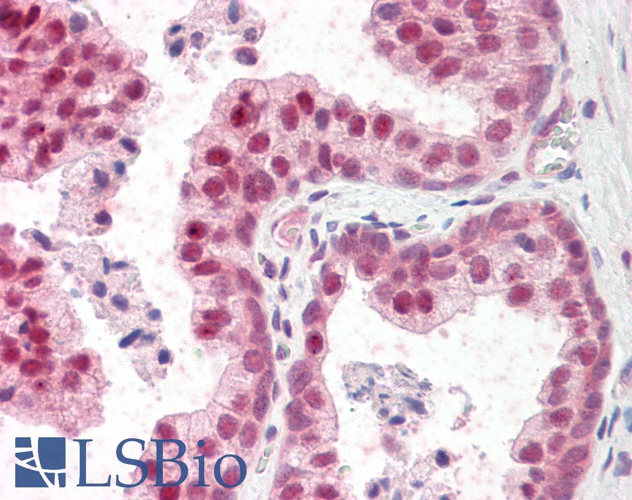 IHC-plus™ TSHZ3 Antibody