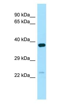 NXNL1 / TXNL6 Antibody (C-Terminus)