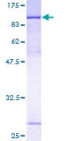 Human ZNF131 Protein (Recombinant GST)