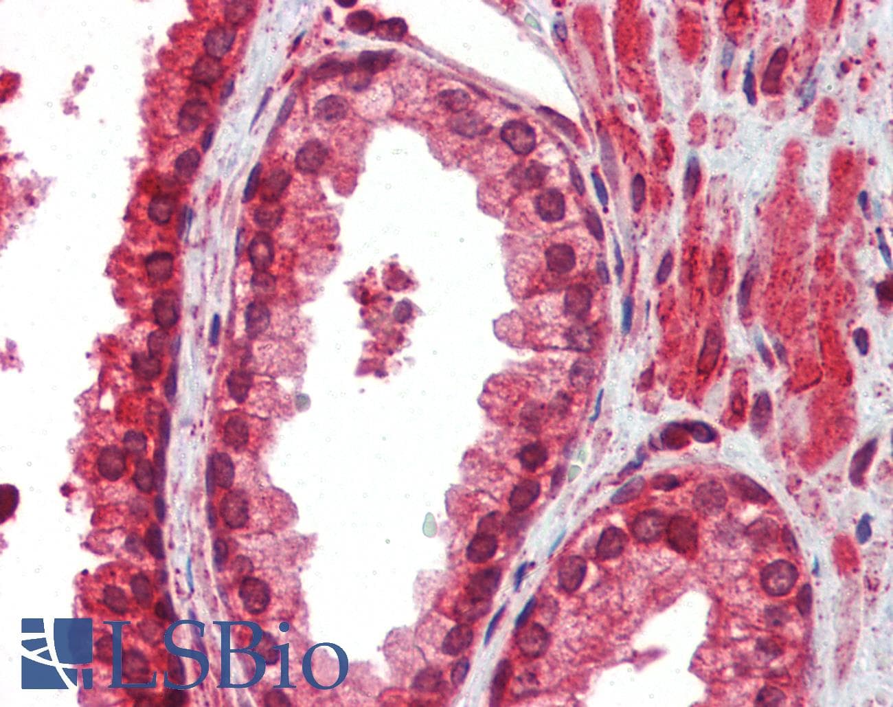 Polyclonal Rabbit anti-Mouse ATF4 Antibody (N-Terminus, IHC, WB)