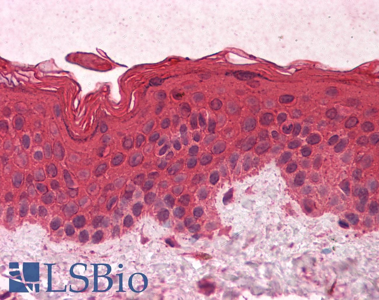 IHC-plus™ GNAI1 / Gi Antibody (clone 2B8-2A5)