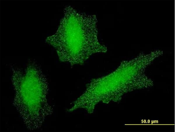 Monoclonal Mouse anti-Human VHL / Von Hippel Lindau Antibody (clone 1G12, IF, WB)
