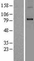 CPT1B Protein (Over-Expression Lysate Myc-DDK (Flag))