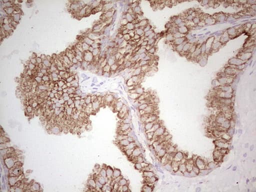 Monoclonal Mouse anti-Human ABCB1 / MDR1 / P Glycoprotein Antibody (clone OTI11D2, aa995-1280, IHC)
