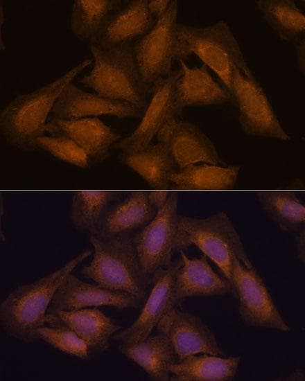 SEPT3 / Septin 3 Antibody