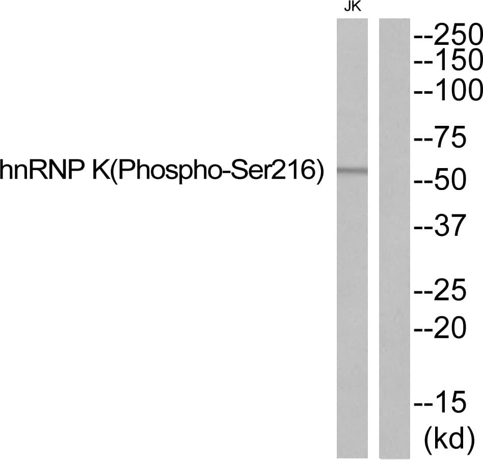 Polyclonal Rabbit anti-Human HNRNPK / hnRNP K Antibody (phospho-Ser216, WB)