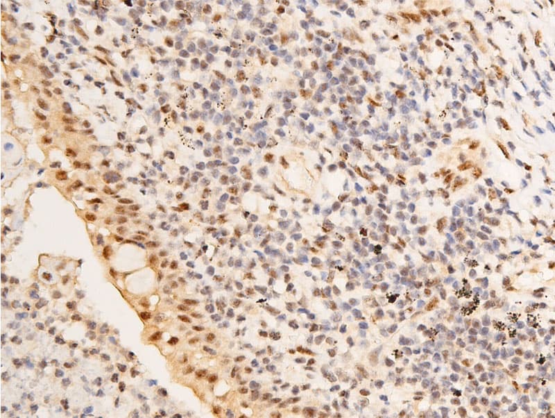 JUN / c-Jun Antibody (phospho-Ser63)