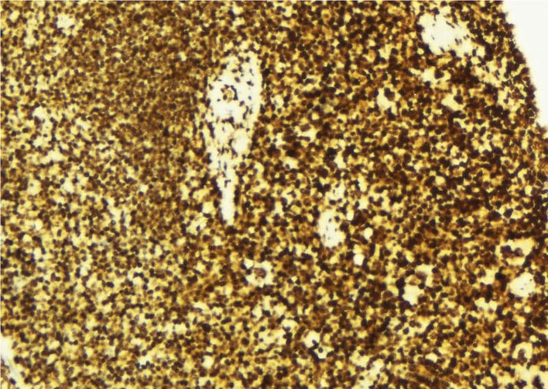 TNFSF5IP1 / CLAST3 Antibody