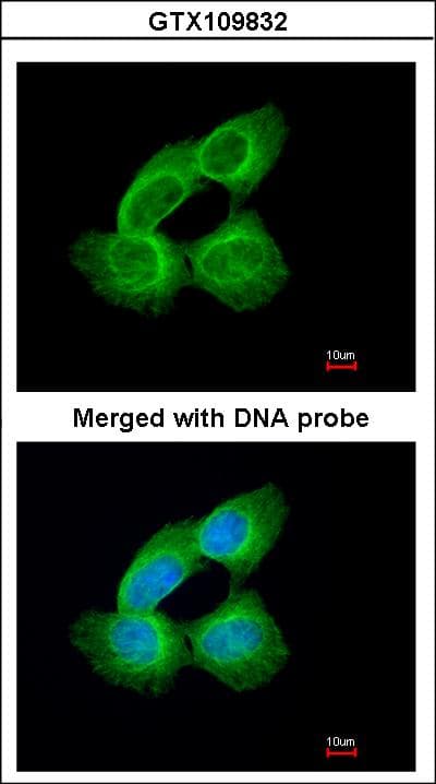 TUBA1A / Tubulin Alpha 1a Antibody (aa37-276)